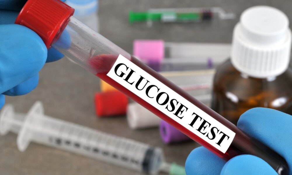 Znaczenie i przeprowadzenie testu obciążenia glukozą w ciąży – wszystko, co powinnaś wiedzieć